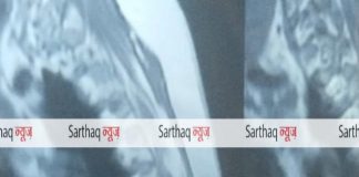 MRI रिपोर्ट पर नज़र आये दो भूत.. जांजगीर जिले में बना चर्चा का विषय..
