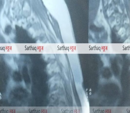 MRI रिपोर्ट पर नज़र आये दो भूत.. जांजगीर जिले में बना चर्चा का विषय..