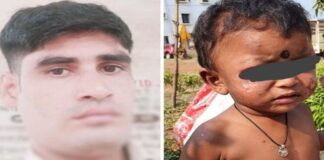 मासूम को 50 बार सिगरेट से दागने वाला आरक्षक गिरफ्तार, होटल में छिपा था आरोपी..