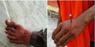 मास्क न पहनने पर पुलिस ने युवक के हाथ-पैर में ठोकी कील, SSP ने कराई जांच तो खुला बड़ा राज..