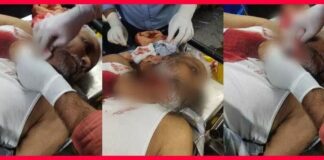 रायपुर में रसूखदारों से परेशान व्यापारी ने खुद का काटा गला, अस्पताल में भर्ती