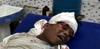 सड़क हादसे में घायल हुए ‘बचपन का प्यार’ फेम सहदेव दिरदो, सिर पर आई गंभीर चोट, इलाज के लिए जगदलपुर रेफर
