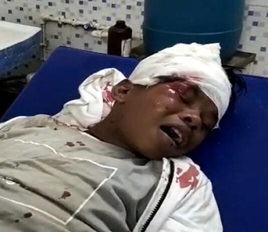सड़क हादसे में घायल हुए ‘बचपन का प्यार’ फेम सहदेव दिरदो, सिर पर आई गंभीर चोट, इलाज के लिए जगदलपुर रेफर