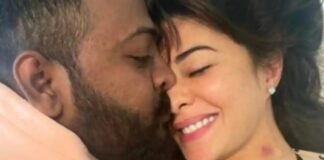 जैकलिन फर्नांडिस को Kiss करता दिखा सुकेश चंद्रशेखर, एक्ट्रेस के गले पर दिखा लव बाइट! वायरल हुई तस्वीर